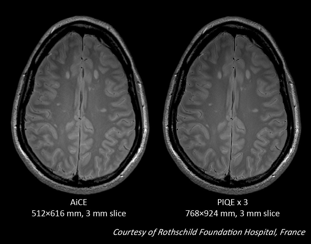 Key Clinical Imaging Tips for V9.0 PIQE Validation Sites in Europe