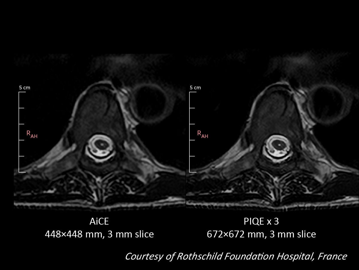 Key Clinical Imaging Tips for V9.0 PIQE Validation Sites in Europe