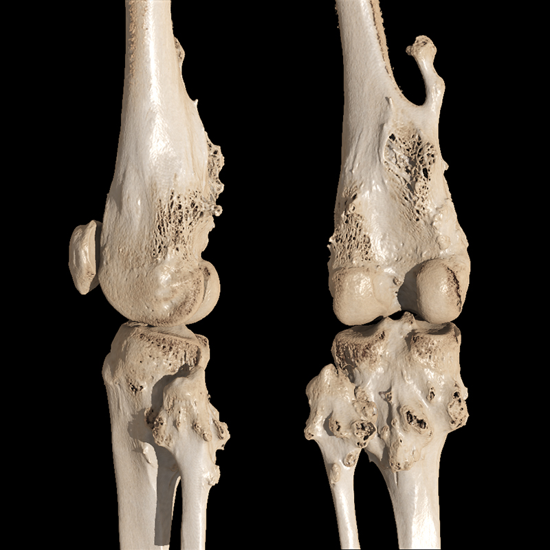 Knee