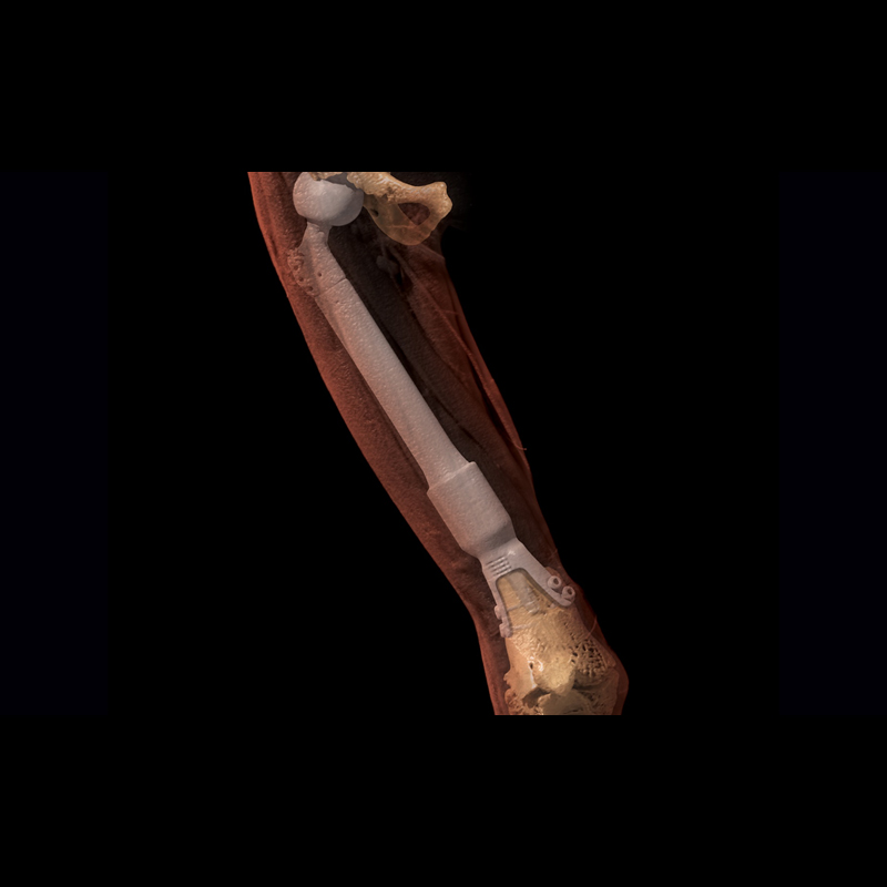 Leg