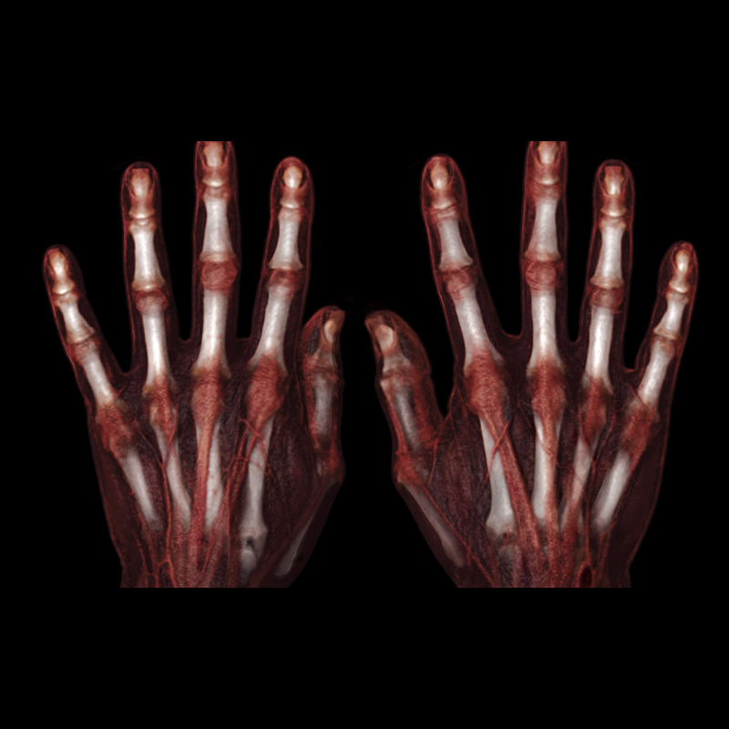Hand